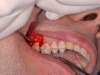 caso-clinico-3-7
