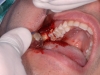 caso-clinico-3-8