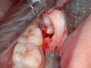 caso-clinico-4-9